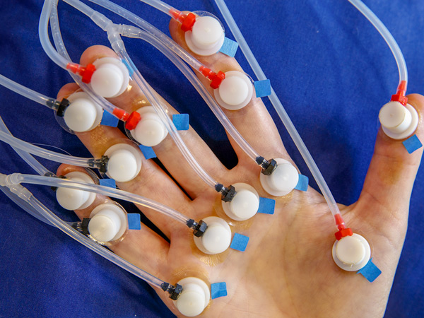 hand with medical equipment attached for testing