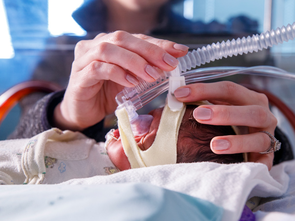 baby in nicu receiving breathing treatment